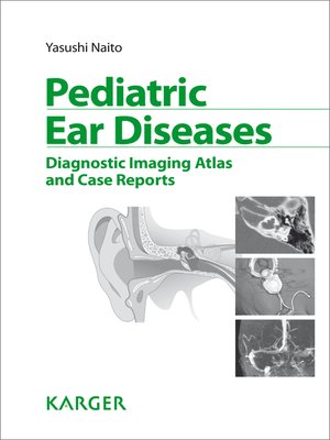 cover image of Pediatric Ear Diseases